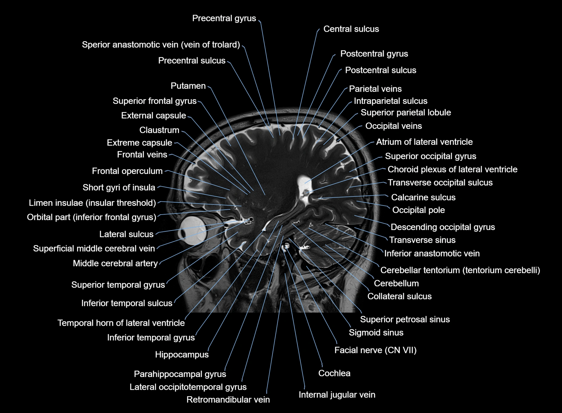 brain sagittal anatomy 3T MRI images -img-00001-00020.webp